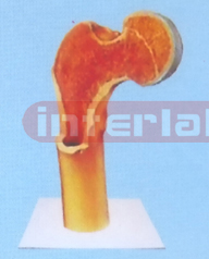 HEALTH FEMUR BONE ANATOMICAL MODEL